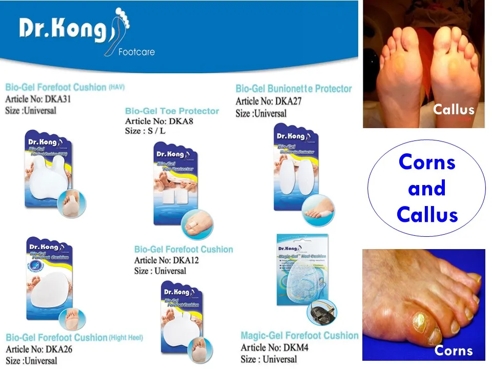 DR.KONG BIO-GEL-BUNION PROTECTOR ACCESSORIES DK-DKA10-F(RP : $16.90)